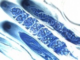 Leptogium cochleatum image