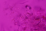Nidularia deformis image