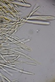 Lachnellula ellisiana image