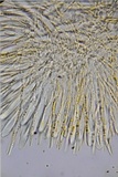 Lachnellula ellisiana image