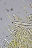 Lachnellula ellisiana image