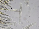 Lachnellula ellisiana image