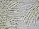 Lachnellula ellisiana image
