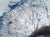 Coccomyces dentatus image
