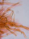 Dacrymyces tortus image
