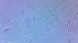 Mitrula lunulatospora image