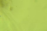 Chlorosplenium chlora image