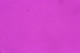 Chlorosplenium chlora image