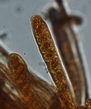 Cenangium ferruginosum image