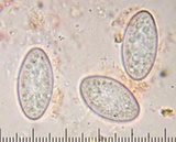 Galiella rufa image