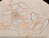 Galiella rufa image