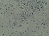 Trichoderma viridescens image