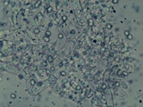 Trichoderma viridescens image