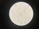 Amanita murrilliana image