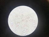 Amanita murrilliana image