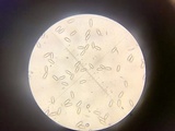 Baorangia rufomaculata image