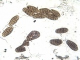 Hysterographium fraxini image