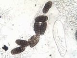 Hysterographium fraxini image