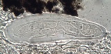 Hysterographium fraxini image