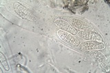 Hysterographium fraxini image