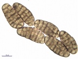 Hysterographium fraxini image