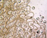 Arcyria cinerea (d3) image