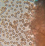 Lycogala conicum image