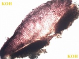 Tephromela atra var. atra image