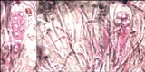 Tephromela atra var. atra image