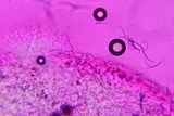 Athelia rolfsii image