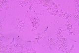 Athelia rolfsii image
