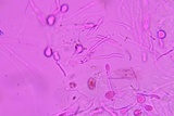 Ductifera pululahuana image