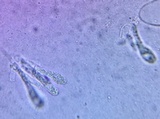 Amanita pseudovolvata image