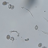 Plasmopara viburni image