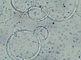 Helicosporium aureum image
