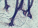 Helicosporium aureum image