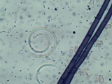 Helicosporium aureum image