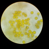 Hypomyces microspermus image
