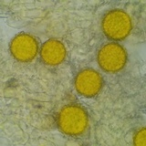 Hypomyces microspermus image