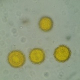 Hypomyces microspermus image