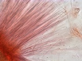 Ascocoryne trichophora image