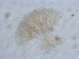 Ascocoryne trichophora image