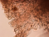 Ascocoryne trichophora image