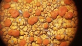 Caloplaca saxicola image