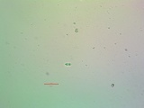 Caloplaca saxicola image