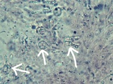 Myxarium subhyalinum image