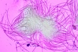 Ophiocordyceps elongata image