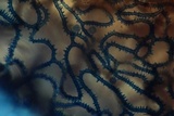 Arcyria denudata image