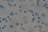 Arcyria cinerea image