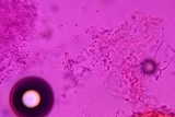 Cordyceps militaris image